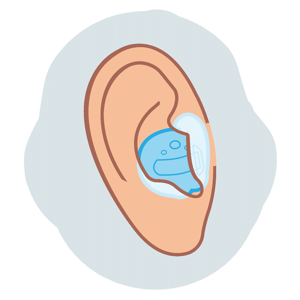 In-the-canal (ITC) hearing aid