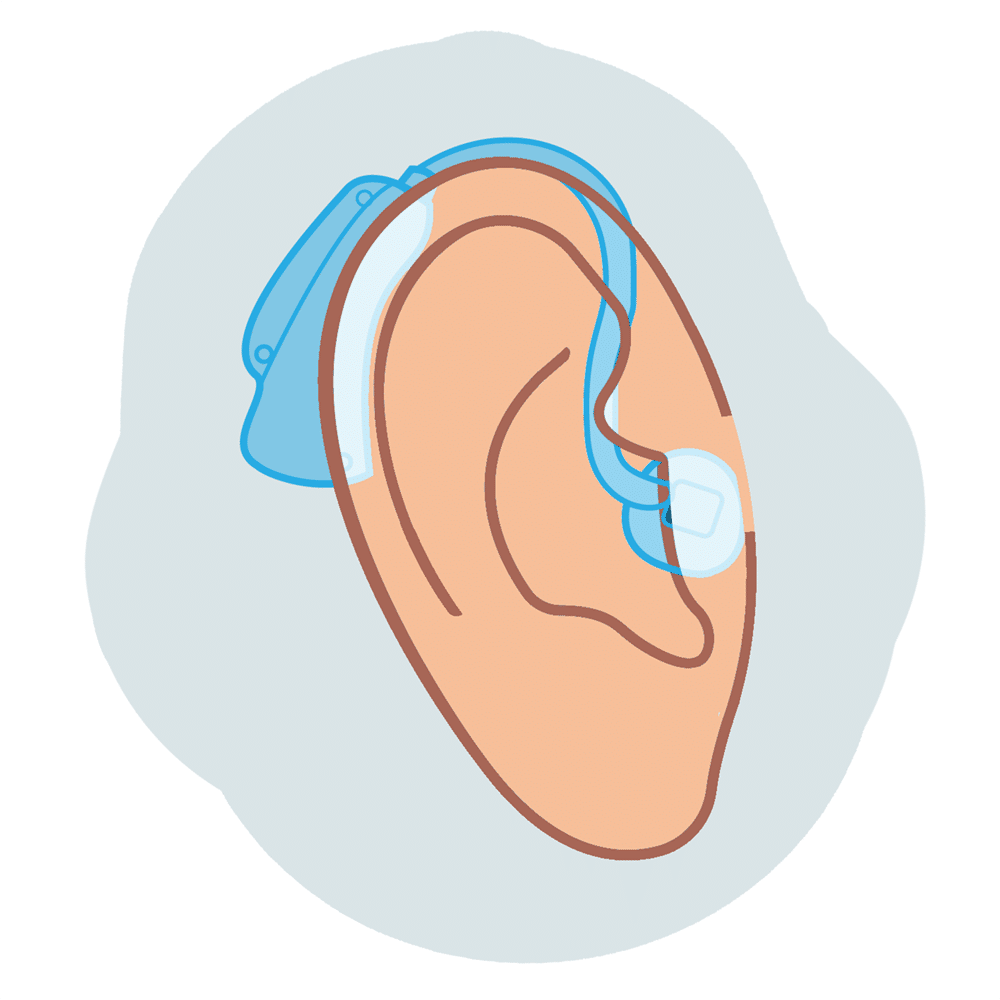 Mini behind-the-ear (mBTE) hearing aid