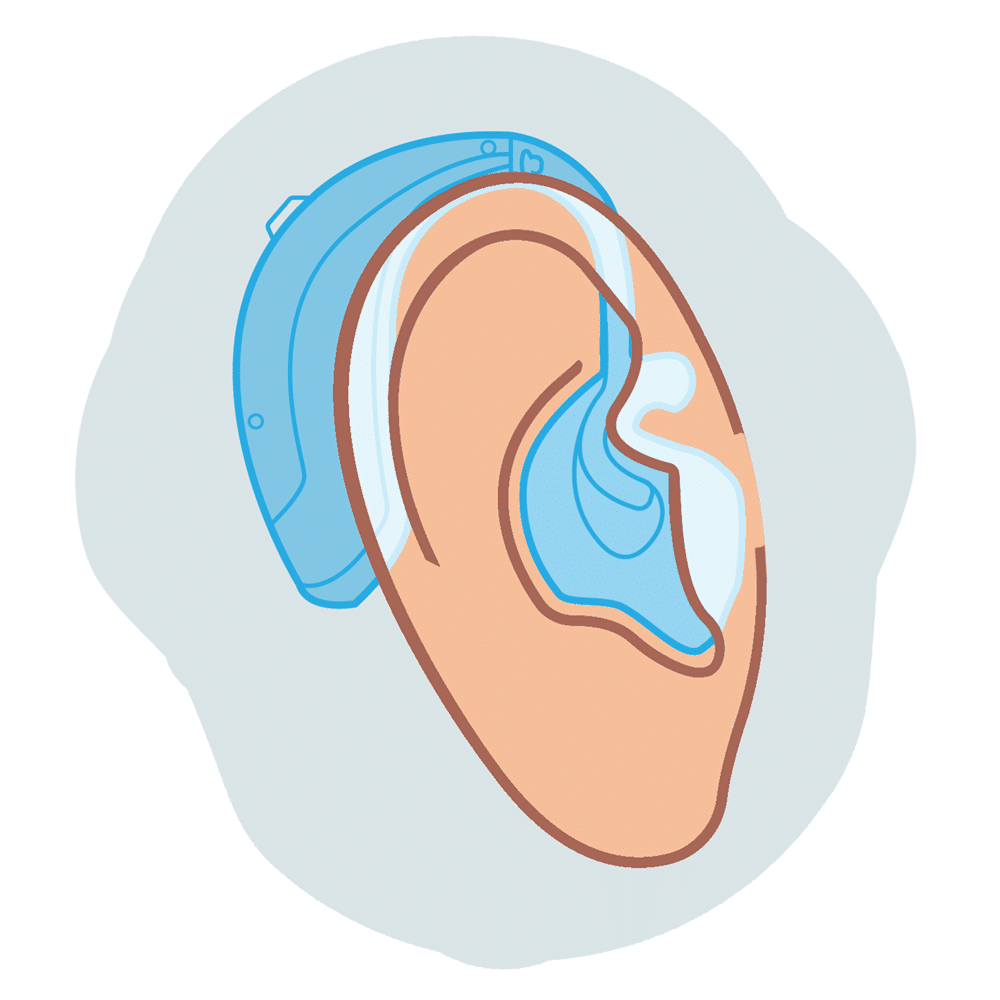 Traditional behind-the-ear (BTE) hearing aid