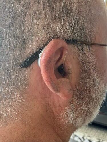 A person wearing hearing aids
