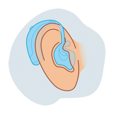 BTE hearing aid illustration