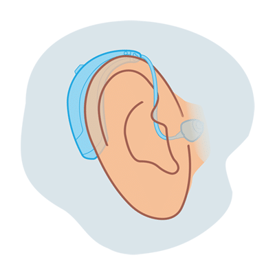 Receiver-in-canal (RIC) hearing aids