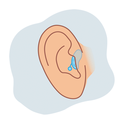 CIC hearing aid illustration
